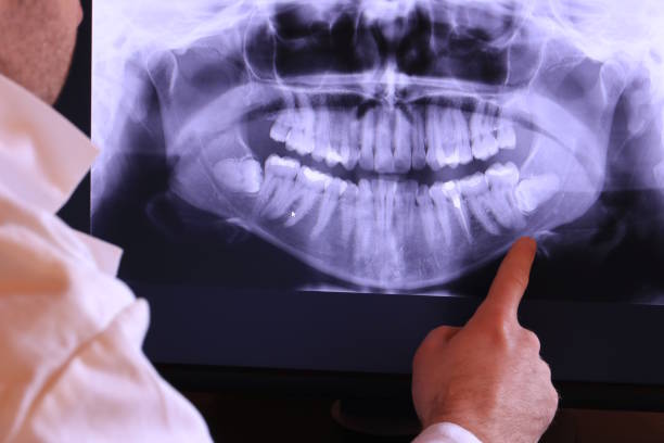 Best Emergency Tooth Extraction in Maynardville, TN