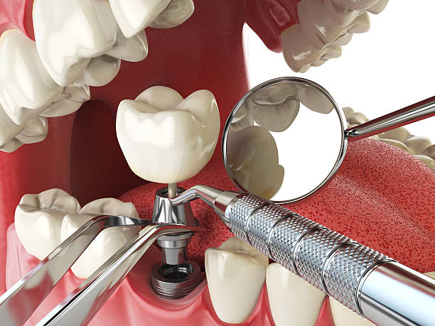Best Walk-In Emergency Dentist in Maynardville, TN
