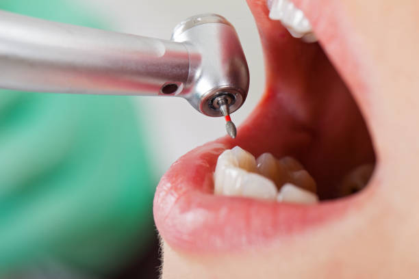 Best Emergency Broken Tooth Repair in Maynardville, TN
